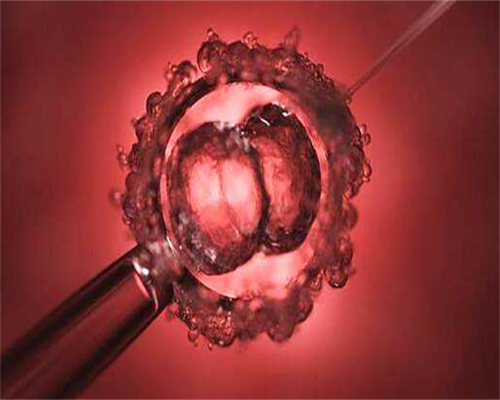 试管婴儿二胎成功率_试管婴儿有什么要求_连云港三院试管婴儿，马来西亚阿儿