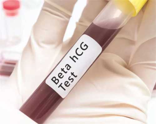 试管婴儿能不能选择生男孩女孩_什么情况下选择试管婴儿_定坤丹适用的五大人