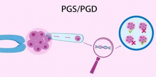 试管婴儿龙凤胎多少钱_试管婴儿哪里可选性别_试管婴儿到底是怎么回事？