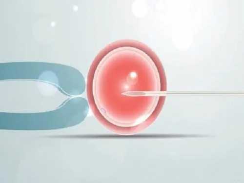 试管婴儿是什么技术_hiv洗精一般多少钱_做试管到底要不要辞职