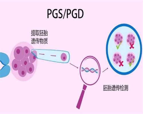 试管婴儿姓别选择_第三代做试管可以选男女吗_VUL1C_在泰国杰特宁做试管婴儿有