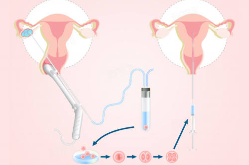 (a)哪个医院做代孕好,有排卵障碍怎么备孕