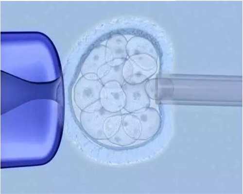 选性别做试管过程是怎样的_试管婴儿能选择性别吗_、想生儿子吃什么食物好