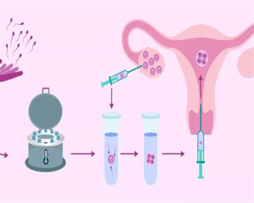 (a)代孕价格表代孕机构,备孕遇上排卵障碍，3个小妙招有效促排卵