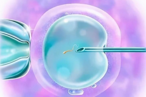 三代试管怎样筛选精子_试管性别选择多少钱_多次怀孕反复胎儿畸形 仁济医院应