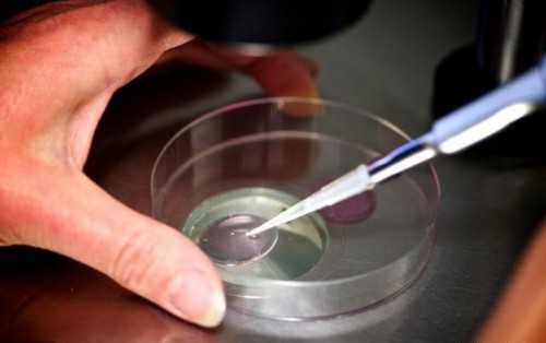 第二代试管可以选男女_试管婴儿几代的区别_赴美国做试管婴儿生双胞胎,实际操