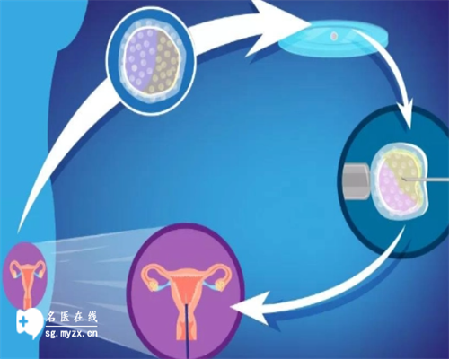 泰国试管婴儿可以选性别吗_第三代试管婴儿怎么筛选性别_567W4_研究发现：试管