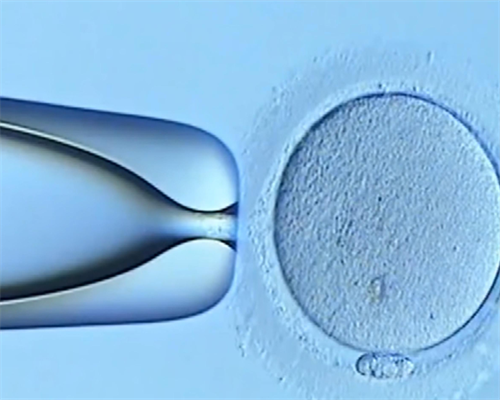 [南京试管婴双胞胎可以选择性别吗]_pd3Tx_56r10_3DYHE_广东地区十个婚检有九个都是