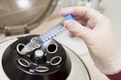 试管婴儿流程_试管婴儿代孕合法吗_天津试管婴儿什么时候纳入医保报销范围