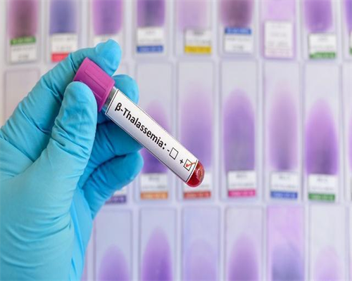 南京代孕方法 如何提升南京试管婴儿成功率？学学这些方法 ‘b超单数据男女’