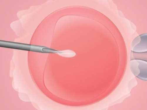 2026试管婴儿多少钱明细表_试管婴儿费用医保报销吗_【供卵试管婴儿成功率高吗