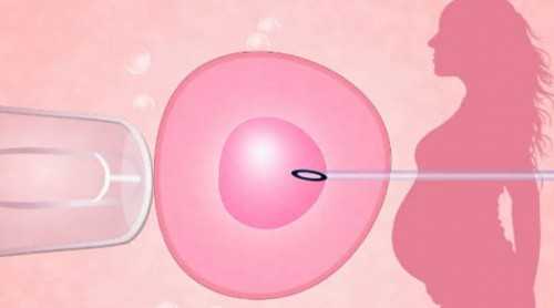 试管婴儿放进子宫图_哪里的试管婴儿可以包性别_舞钢市可以做试管婴儿吗？能