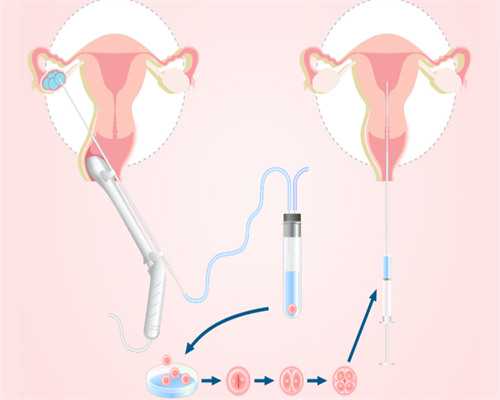 试管可以选择双胞胎吗_试管婴儿可以做龙凤胎吗_5h67t_子宫肌瘤，卵巢囊肿，谷