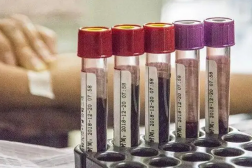 供卵试管机构精因宝贝肯定_英国做试管可以选择男女吗_图解试管婴儿花费明细