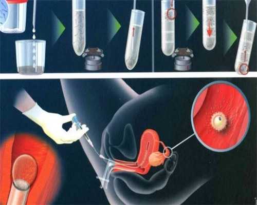 (a)哪家代孕医院专业,经历宫外输卵管通而不畅 备孕成功经验分享