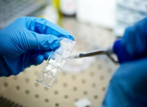 广州试管可以选择性别吗_泰国试管能选性别吗_amh值偏低，调理后有可能回升吗