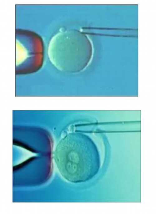 江苏想找助孕中介 2026在江苏做第三代试管婴儿选择东部战区总医院好还是南京