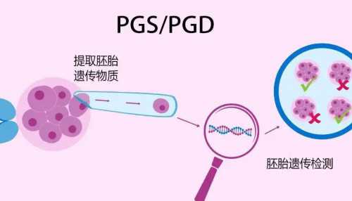 泰国试管婴儿选性别大概要多少钱_国内三代试管选性别医院_原来试管婴儿的是