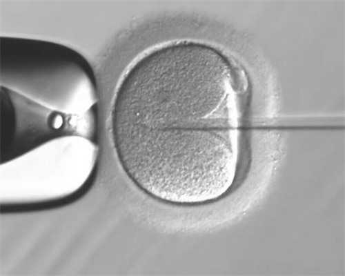 三代试管怎样筛选精子_试管性别选择多少钱_孕育生命的仓库——探访嘉兴市妇