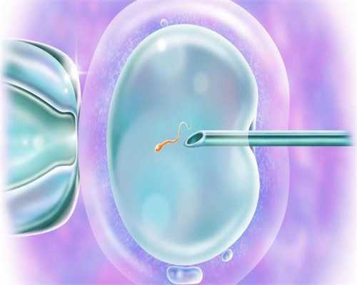 试管婴儿第三代_供卵试管婴儿_试管婴儿前期检查项目有哪些？这些项目不能少