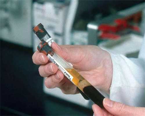 试管婴儿检查项目明细表_试管婴儿_海南有几家三代试管医院？