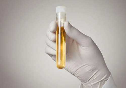 南京90万包成功包男孩 南京妇幼保健院供精试管婴儿流程 ‘早期孕囊图片看男