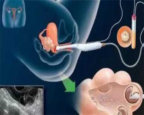 泰国试管婴儿多少钱就选唯美加_供精试管婴儿家庭现状_孕妇梦到龙结果生女儿