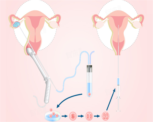 三代试管能选择性别吗_供精试管生的孩子都健康吗_在北京大学滨海医院做试管