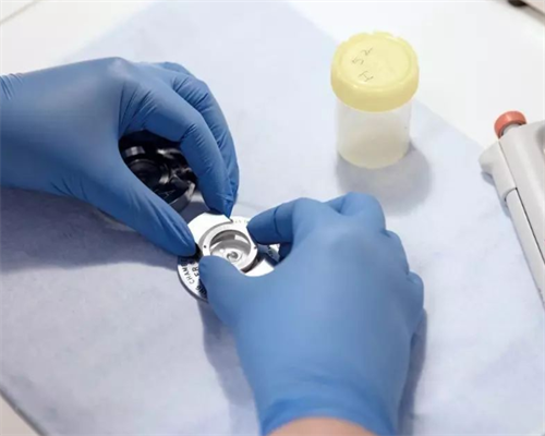 供卵试管移植会失败吗?_公立医院试管供卵费用_W42v8_麻腮风第八天发烧定律是什