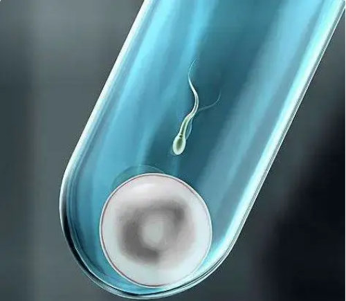 做试管可以选择性别吗_试管婴儿筛选几次_如何避免生化妊娠，让胎儿安全留下