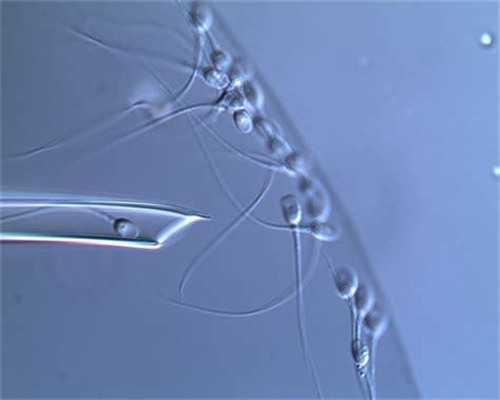 二代试管婴儿能选性别吗_龙凤胎都是试管婴儿吗_做试管婴儿，卵子质量的重要