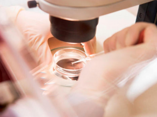 绝经后借卵能不能做试管_借卵试管选性别_试管婴儿微刺激方案过程全介绍，你