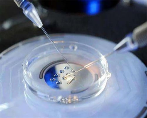 试管婴儿包男孩靠谱吗_试管能选择胎儿性别吗_7W354_新疆石河子试管婴儿医院成