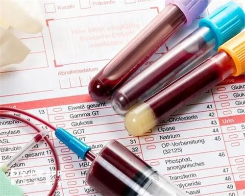 试管婴儿的精子从哪里来_试管一次成功率有多高_做试管婴儿有什么优惠政策？