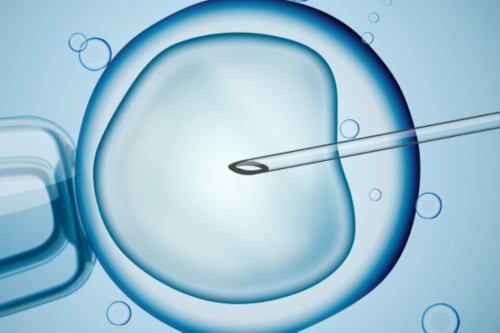 (a)代孕协议有效吗,人工授精和试管婴儿并不是一回事?想要生孩子,备孕夫妻尽量