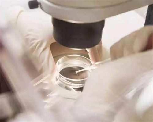 试管婴儿有什么要求_试管婴儿价格低的医院_梦美指南：宫外孕使生育受阻，赴