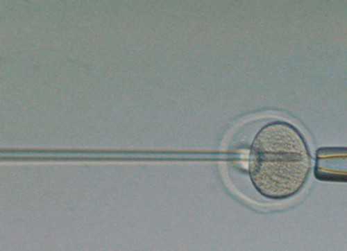 试管婴儿一次成功率_试管婴儿生下来健康吗_【供卵试管与母亲没有血缘关系吗