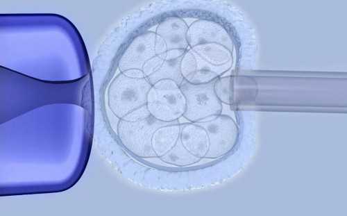 试管婴儿是有性生殖吗_四代怀孕第三代试管选性别_e0BVb_医生建议临界风险患者